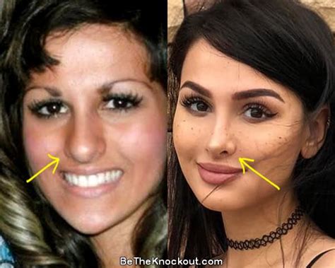 sssniperwolf before after|Sssniperwolf Before Plastic Surgery: How Was She。